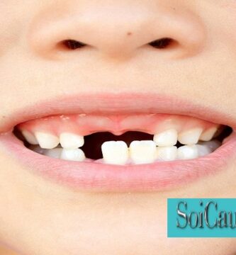 Tìm Hiểu Nằm Mơ Thấy Rụng Răng Đánh Con Gì?